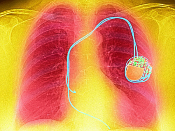 Wearable/embedded medical devices