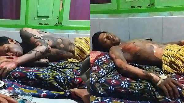 இருதினங்களாக தீவிர அவசரசிகிச்சை பிரிவில் சிகிச்சை