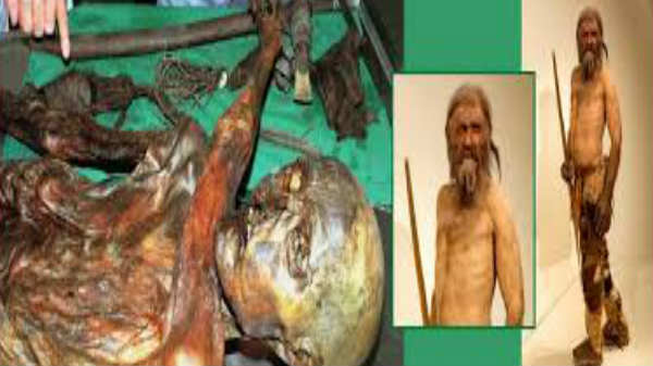 இறப்புக்கு காரணம்: