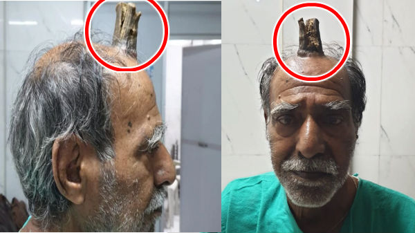 தலையில் கொம்புடான் வாழும் ஷாம்