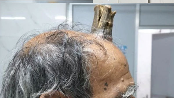 சூரிய ஒளிபட்டால் வளரும் கொம்பு