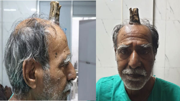 நவீன முறைகளைப் பயன்படுத்தி அறுவை சிகிச்சை