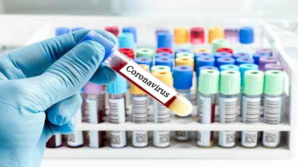 அமெரிக்காவில் 160 பேருக்கு கொரோனா